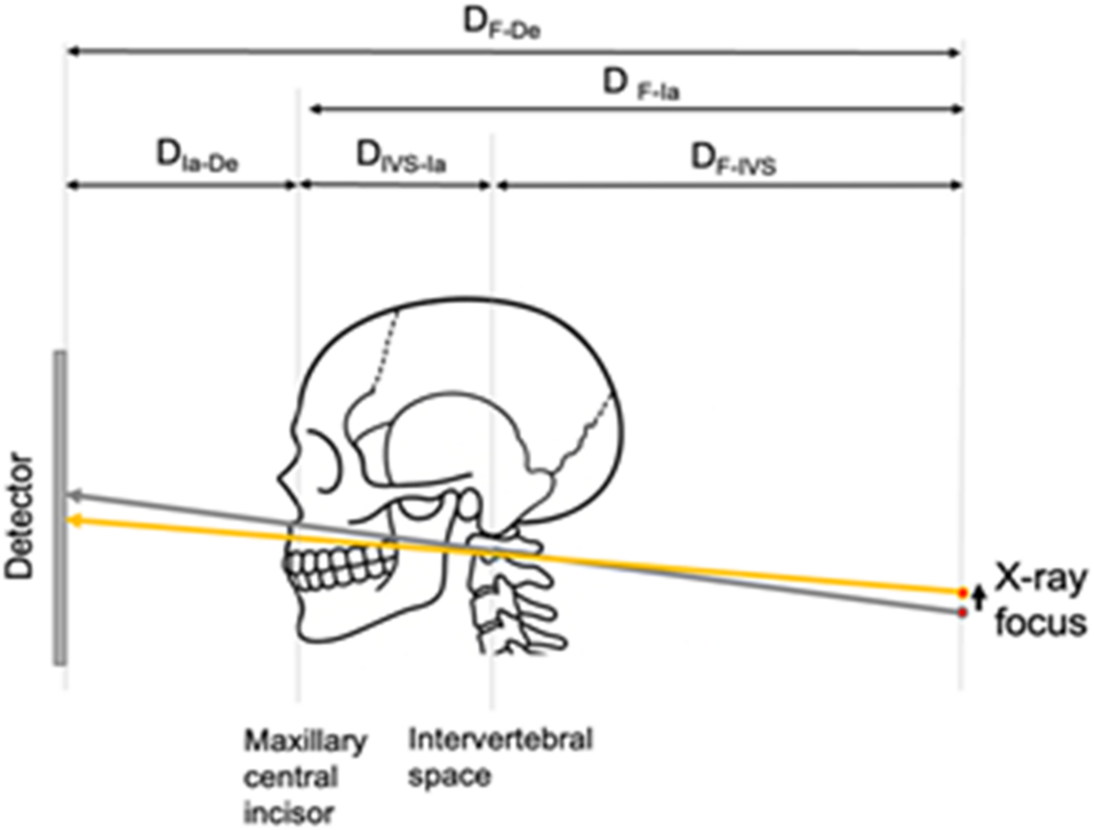 Optimal elevation distance of the X-ray focus in vertical dual-exposure panoramic radiography for mitigating ghost images of cervical vertebrae in the upper incisor region