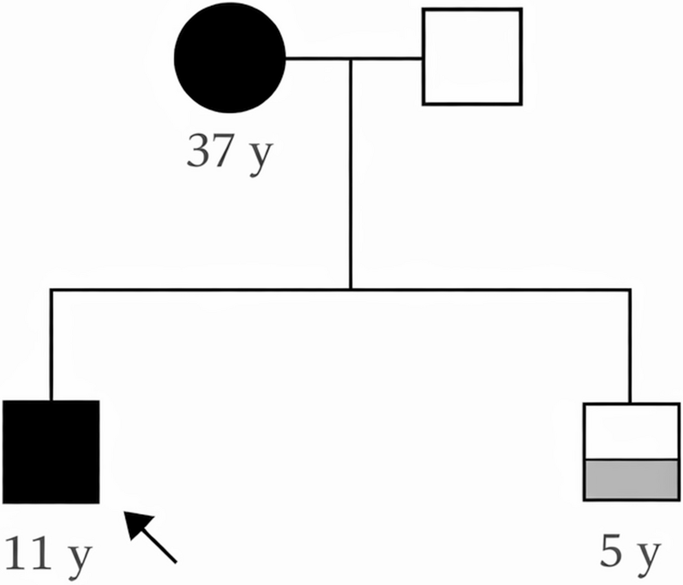 Prolonged episodic ataxia associated with a SCN2A variant: intrafamilial phenotypic heterogeneity and adult vestibulo-cerebellar presentation