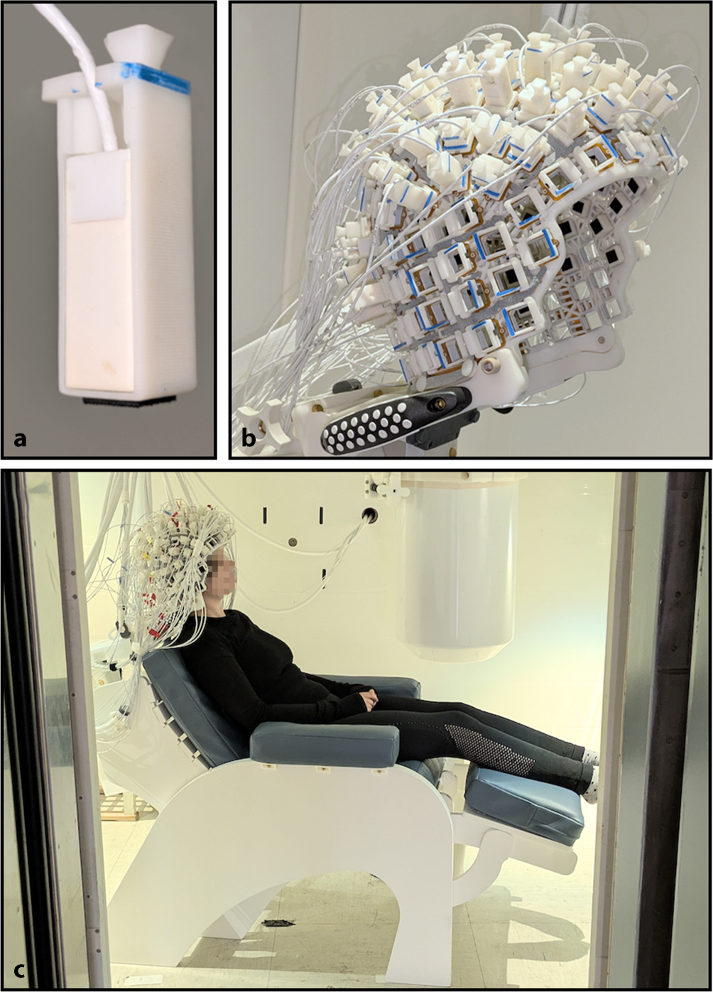 Magnetenzephalographie mit 120 optisch gepumpten Magnetometern (OPM-MEG) bei Epilepsie: Pilotmessungen zur Überprüfung der Machbarkeit
