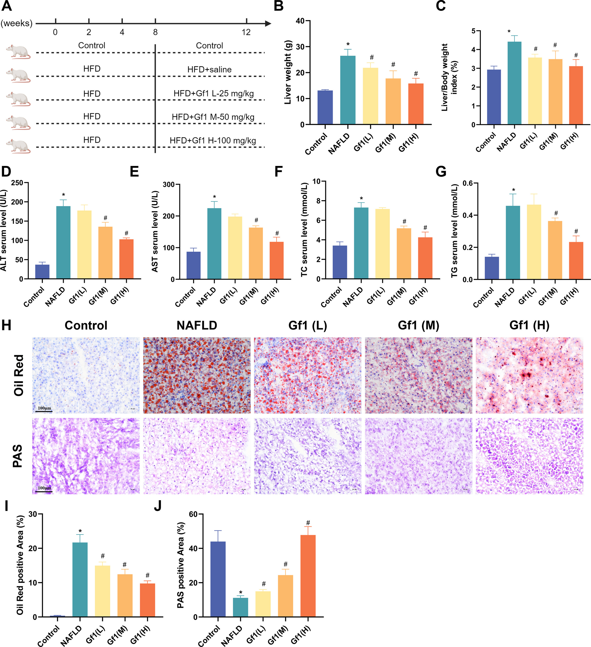 Ginsenoside F1 ameliorates nonalcoholic fatty liver disease by activating the AMPK/PGC-1α pathway and autophagy