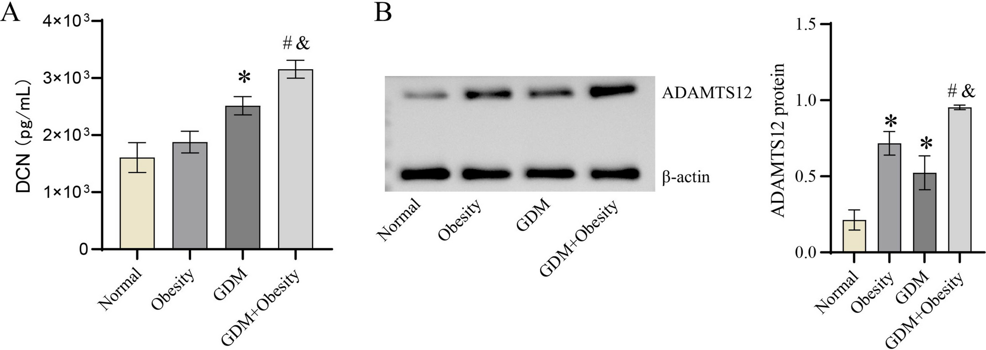 Decorin inhibits the migration and invasion of the LPS + high glucose–induced primary trophoblast cell through ADAMTS12