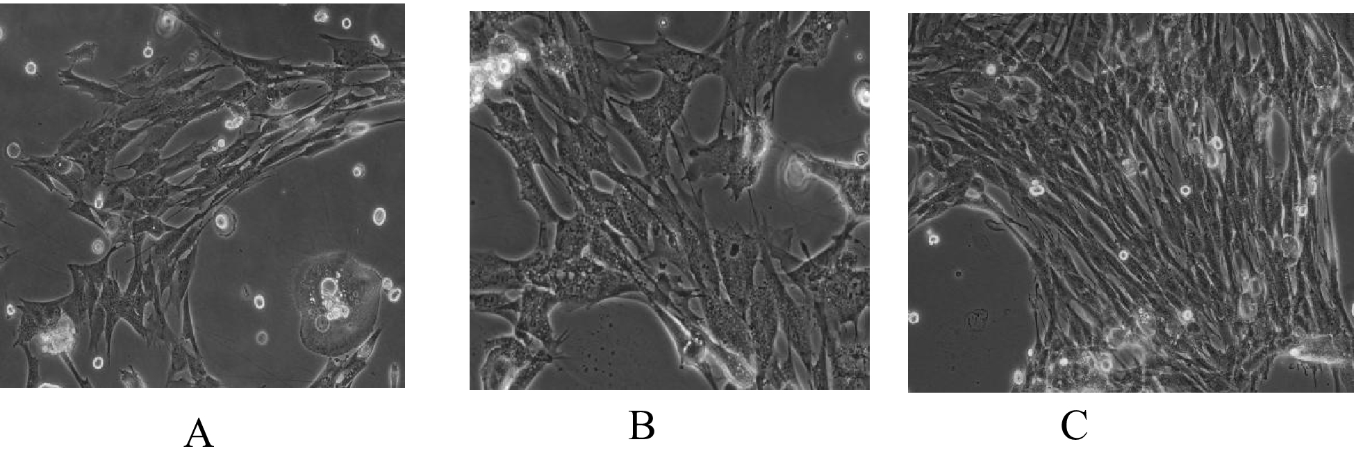 Construction of tissue-engineered vascular sinoatrial node in vitro