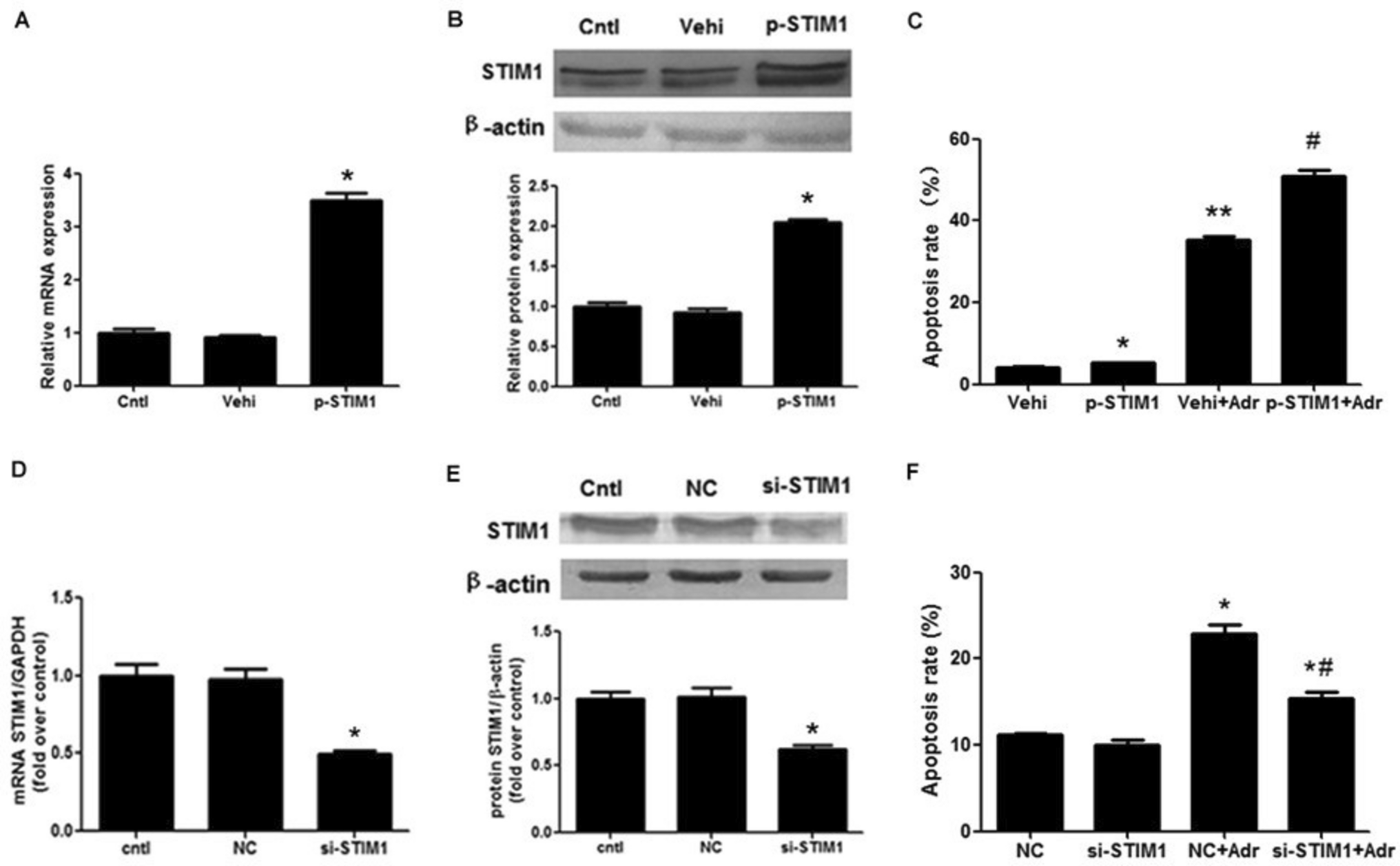 A preliminary study on the mechanism of stromal interaction molecule 1 (STIM1) involvement in Adriamycin-induced podocyte injury