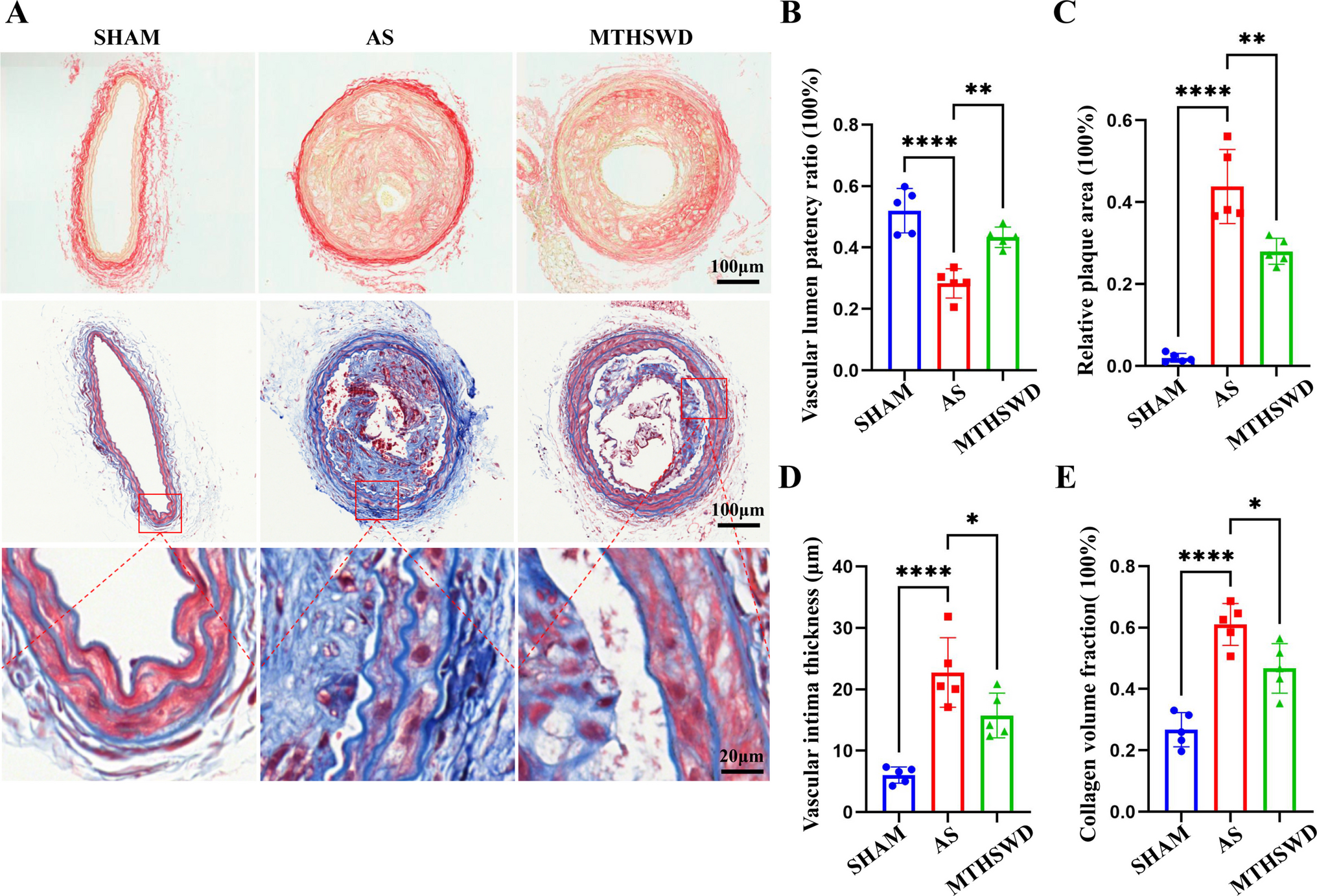 Network pharmacology analysis and experimental validation of modified Taohong Siwu decoction against atherosclerosis
