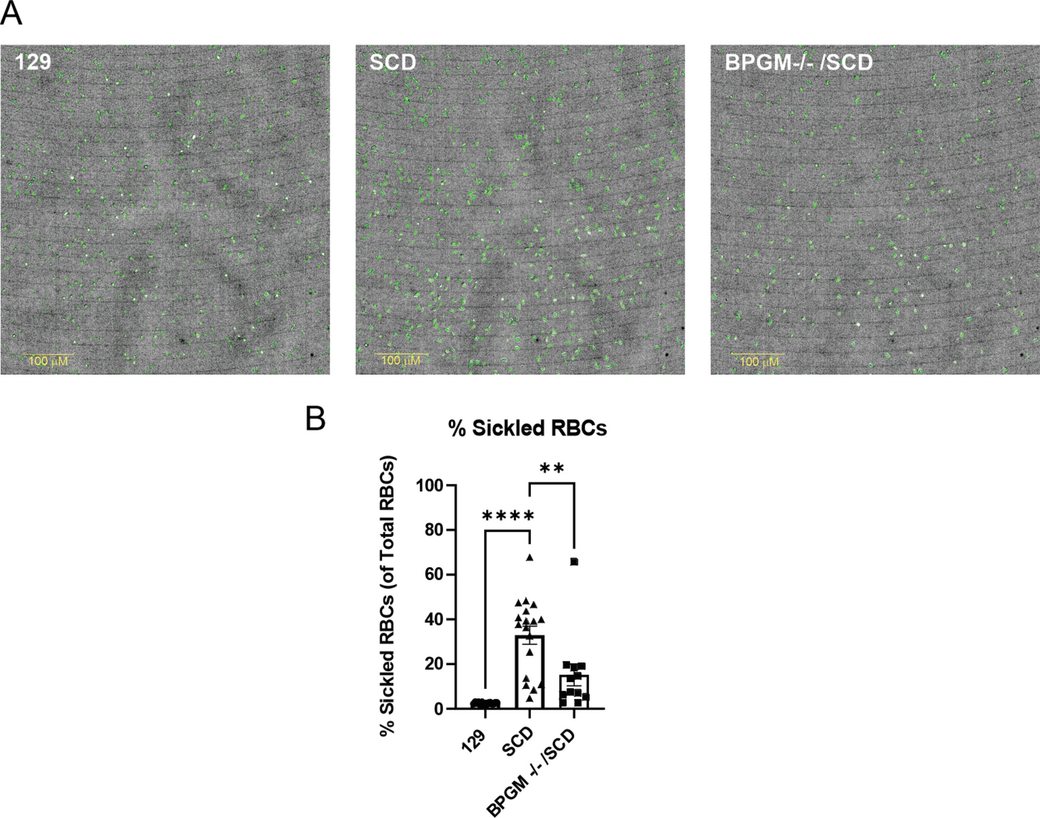 Photoacoustic Imaging of Muscle Tissue Oxygenation as a Noninvasive Biomarker in Mouse Models of Sickle Cell Disease