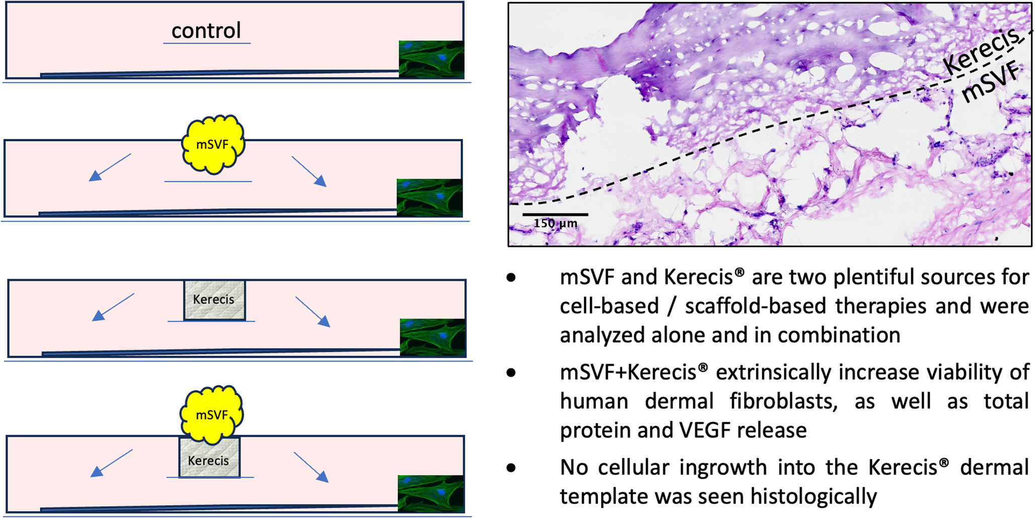 Synergistic Effects of Kerecis Fish-Skin Dermal Scaffold and Stromal Vascular Fraction (mSVF)