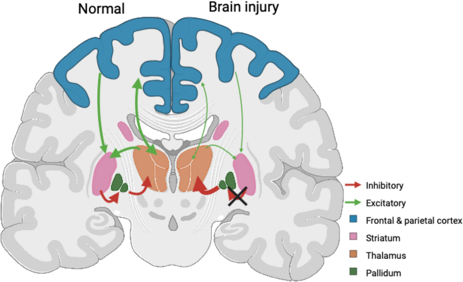 Pharmacotherapy in Disorders of Consciousness: A Mechanism-Based Review