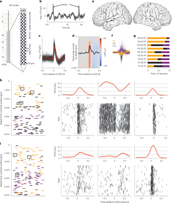 Laminar organization of cellular microcircuits modulating human interictal epileptiform discharges
