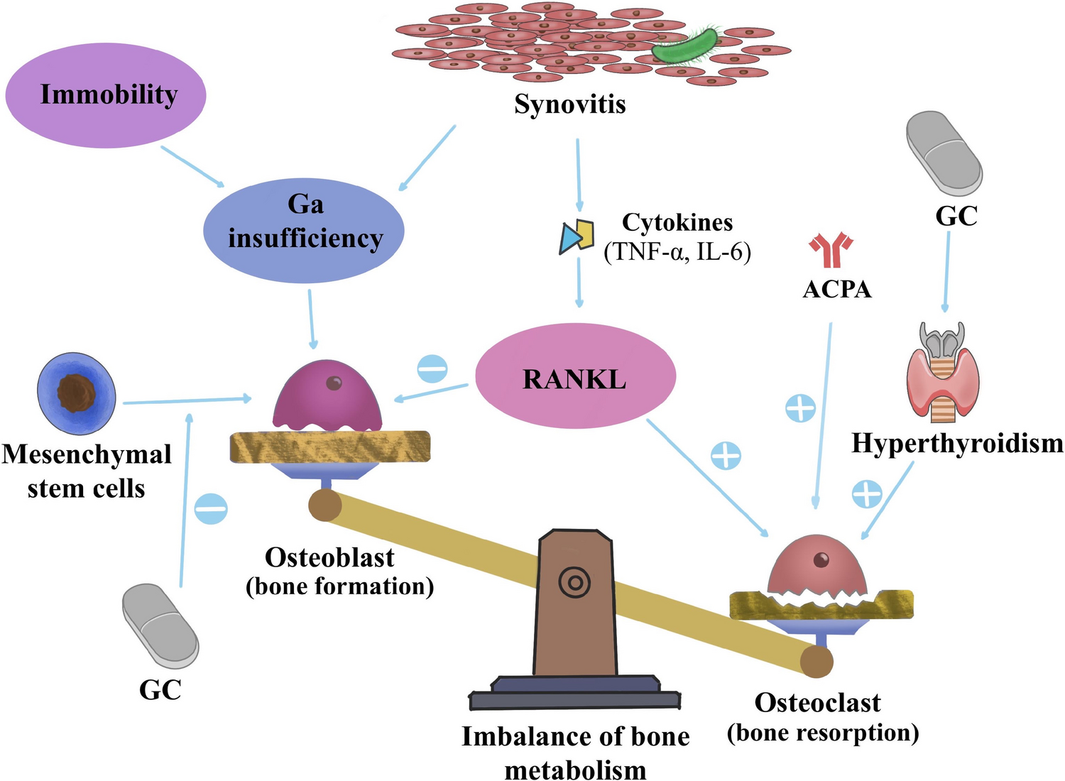 Osteoporosis in rheumatoid arthritis: a new perspective on risk factors and clinical prediction models