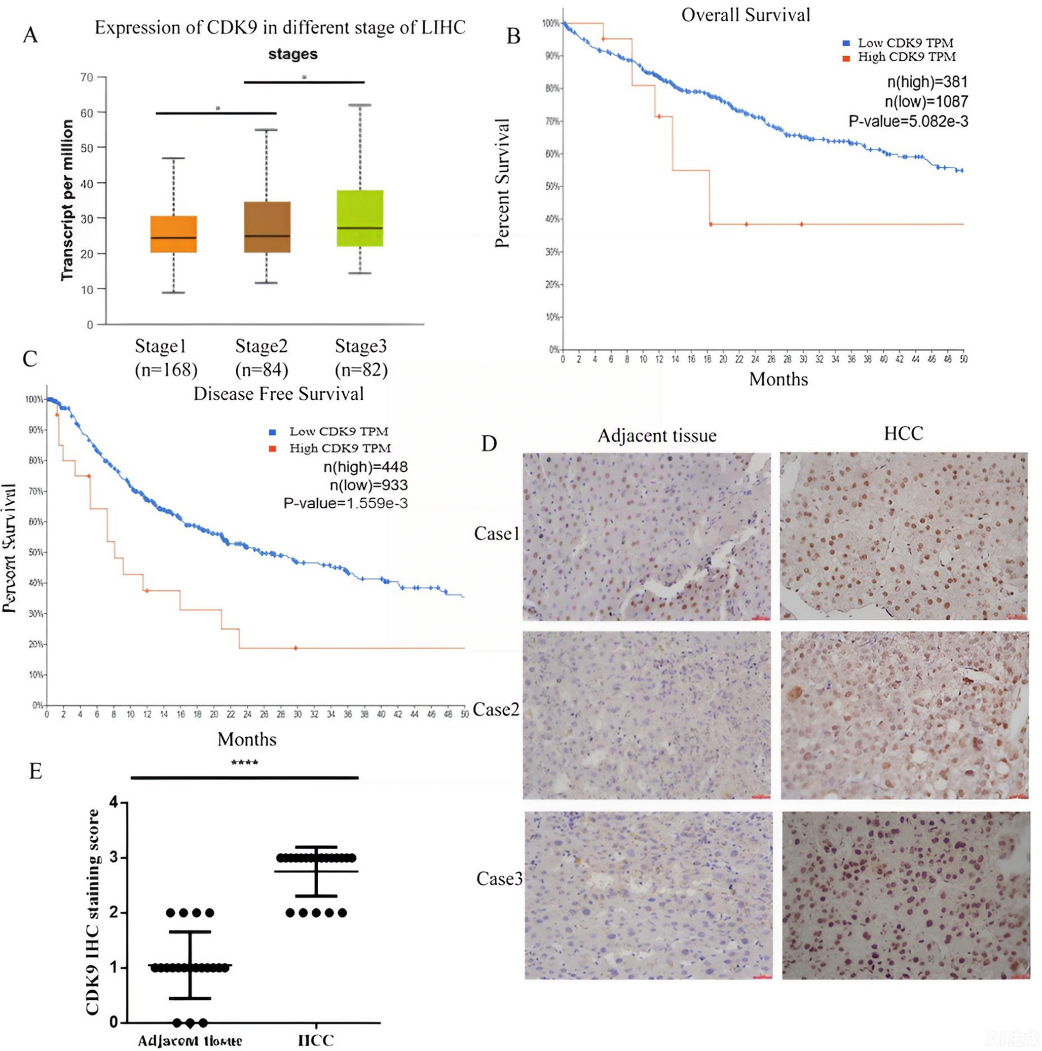 CDK9 inhibition triggers MT2A-dependent apoptosis in HCC cells