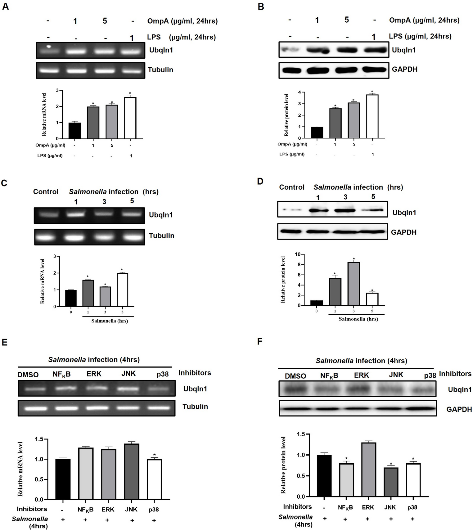 Ubiquilin 1 Inhibits intracellular proliferation of  through Xenophagy