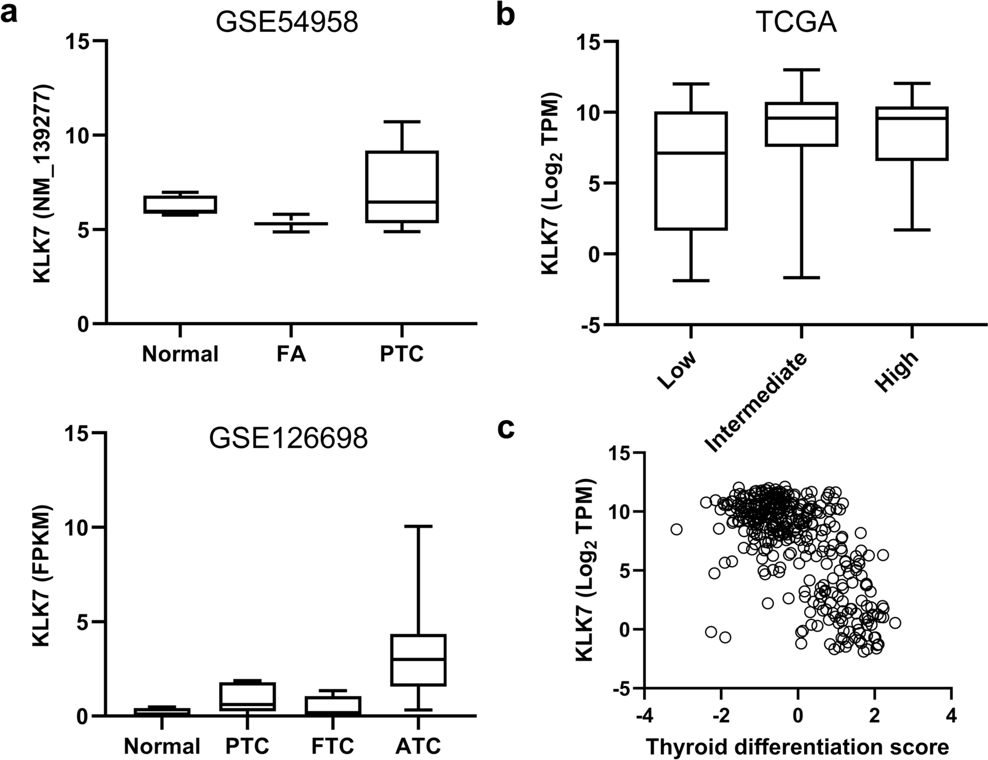 Oncogenic overexpression of kallikrein-related peptidase 7 is associated with the progression of thyroid cancer