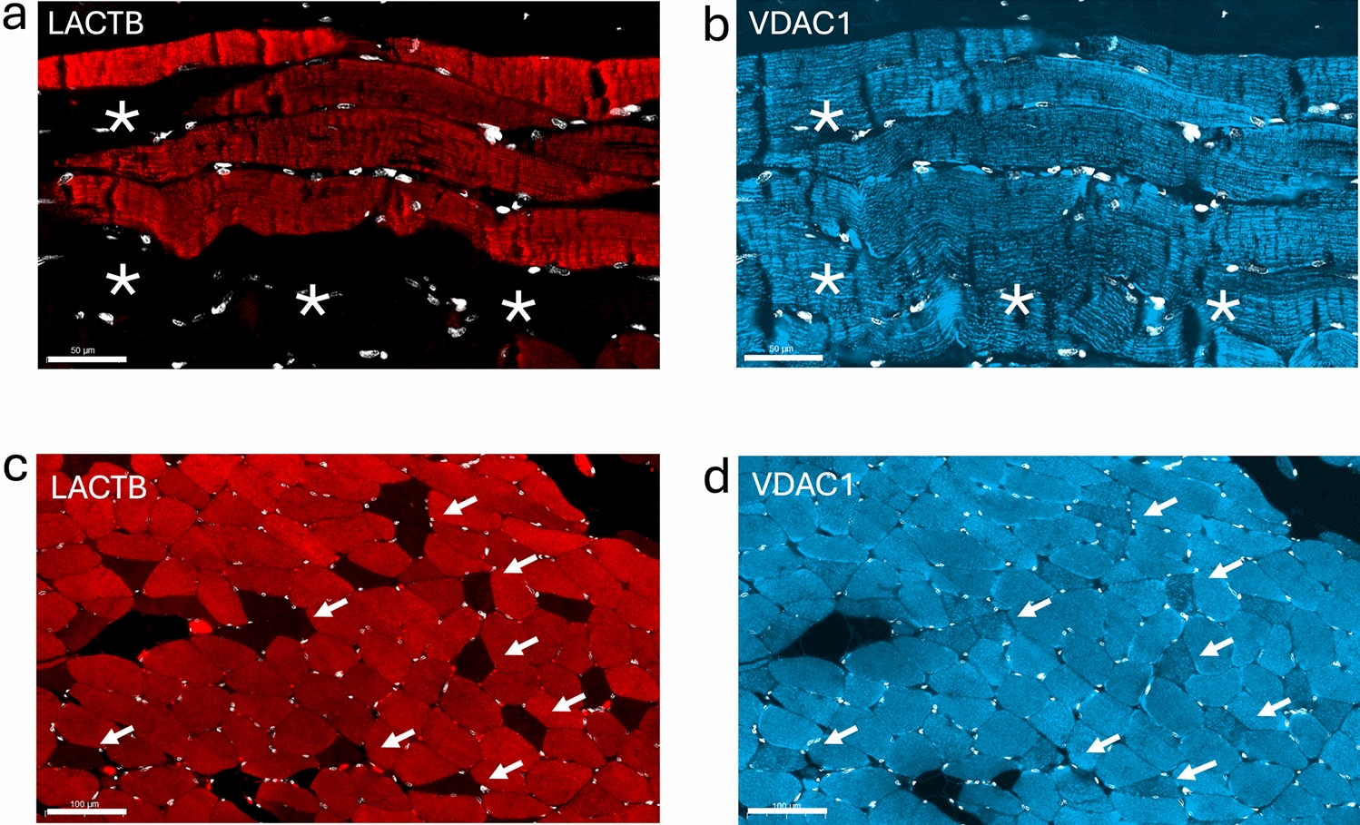 Fiber type-specific expression of LACTB leverages a function in oxidative metabolism