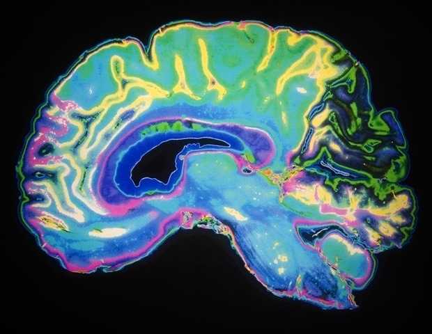 New fMRI neurofeedback study trains the brain to reduce depressive rumination