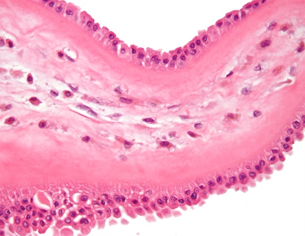 Rhein protects against intestinal injury in severe acute pancreatitis