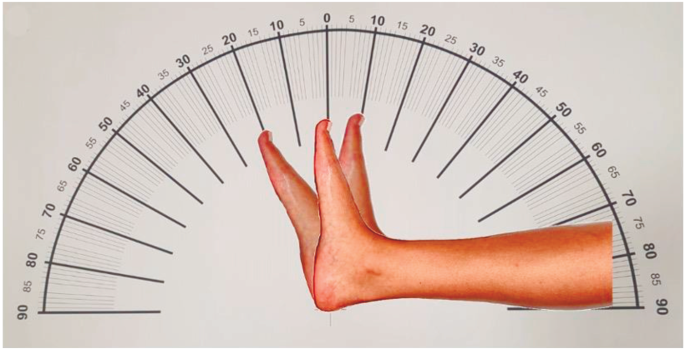 Eight-week Combined Exercise Reduces Fall Risk in Older Females: Posttest-Only Randomized Experimental Study