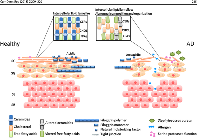Epithelial Barrier Dysfunction in Atopic Dermatitis, Allergic Contact Dermatitis, and Chronic Spontaneous Urticaria and its Therapeutic Implications