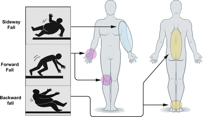 The Effects of Obesity and Weight Loss Interventions on Bone Health: A Narrative Review