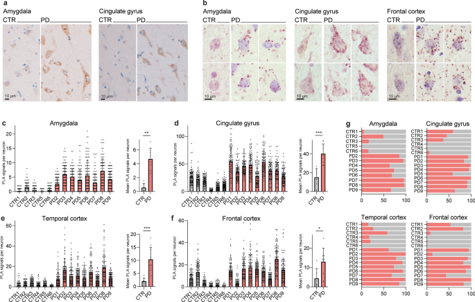 GRP78 associates with alpha-synuclein in vulnerable neurons of the Parkinson’s disease brain