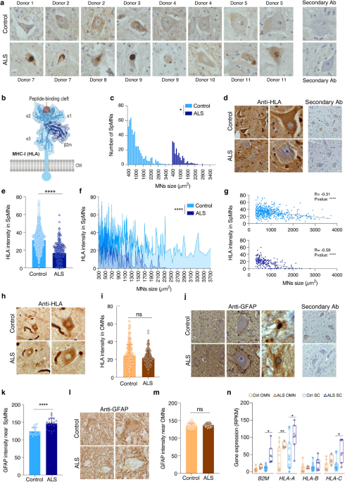 Reevaluating the role of beta2-microglobulin: new insights on selective vulnerability in ALS pathology