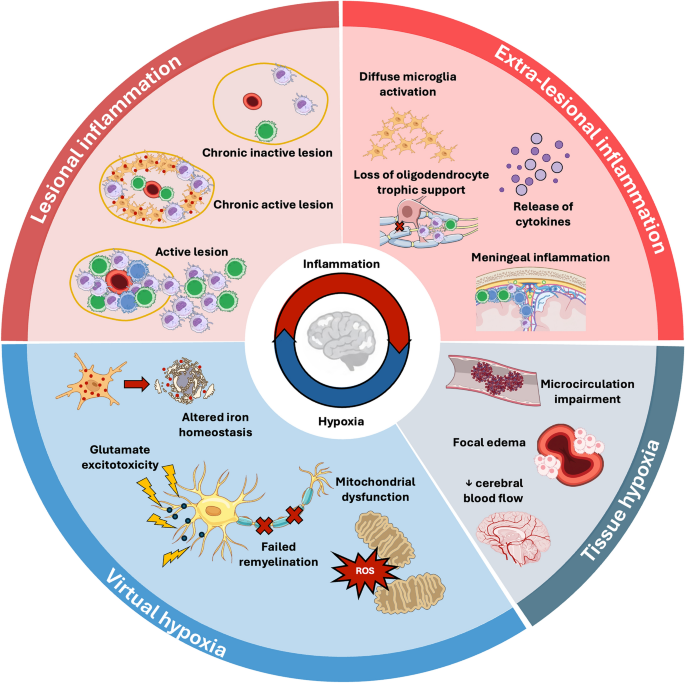 The hypoxia-inflammation cycle as a key mechanism of smoldering inflammation and progression in multiple sclerosis