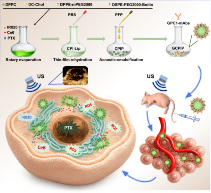 Investigation of a GPC1-targeted and LIFU-responsive nanoplatform with ADV effect for visualized chemo-sonodynamic therapy against pancreatic ductal adenocarcinoma