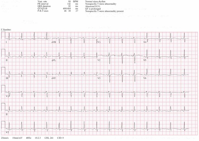 Management challenges in delirium in genetically confirmed long QT syndrome: a case report and discussion