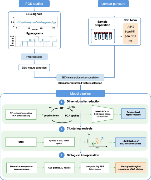 Quantitative sleep EEG identifies CSF core biomarker-related subgroups in Alzheimer’s disease