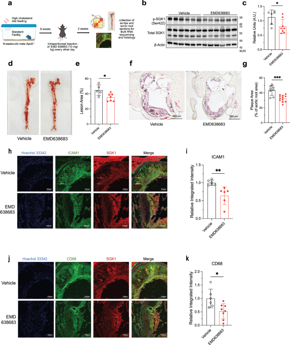 Serum/glucocorticoid-regulated kinase 1 regulates vascular inflammation in atherosclerosis