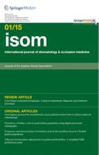 Eagle’s syndrome - a case report