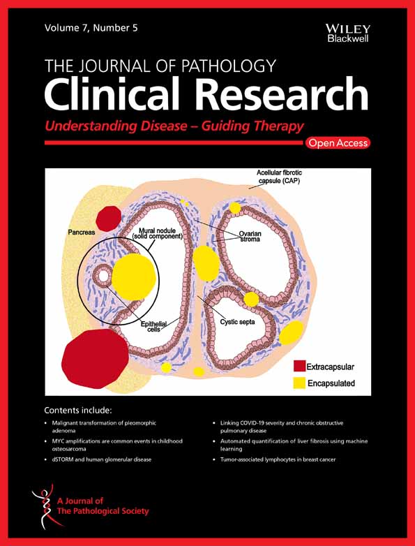 Somatic intronic TP53 c.375+5G mutations are a recurrent but under‐recognized mode of TP53 inactivation