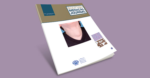 Waist circumference, hip circumference, arm span, and waist-to-hip ratio high risk of polycystic ovarian syndrome