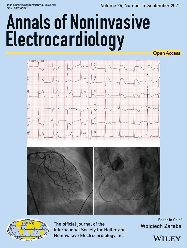QTc interval on 24‐hour holter monitor: To trust or not to trust?