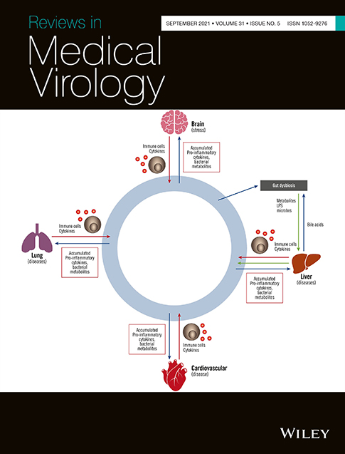 A comparison with historical influenza prompts better planning for Covid‐19 and future pandemics, and gives grounds for optimism