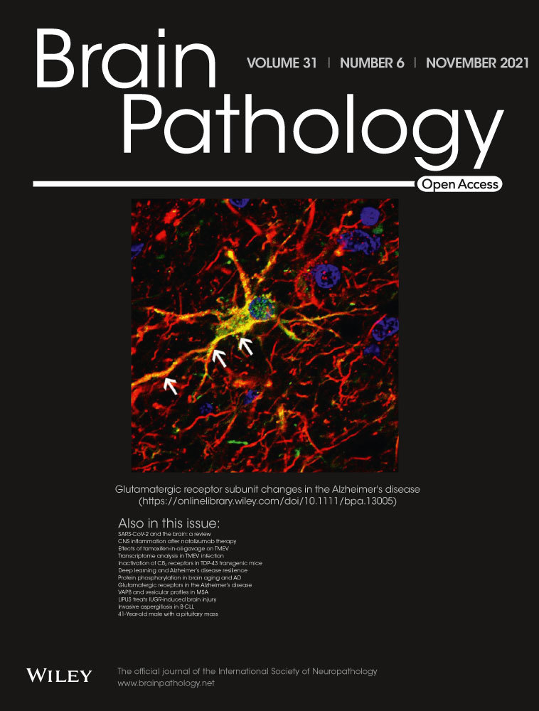 A 2‐year‐old girl with posterior fossa mass