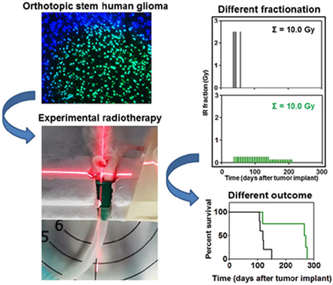 Ultra‐hyper‐fractionated radiotherapy for high‐grade gliomas