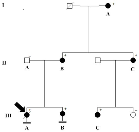 Cardiogenetics, Vol. 11, Pages 219-229: Arrhythmogenic Cardiomyopathy—Further Insight into the Clinical Spectrum of Desmoplakin Disease
