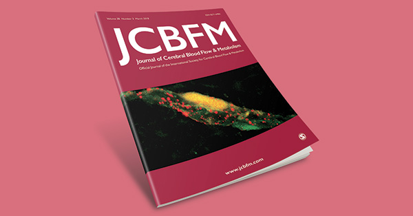 White matter damage due to pulsatile versus steady blood pressure differs by vascular territory: A cross-sectional analysis of the UK biobank cohort study