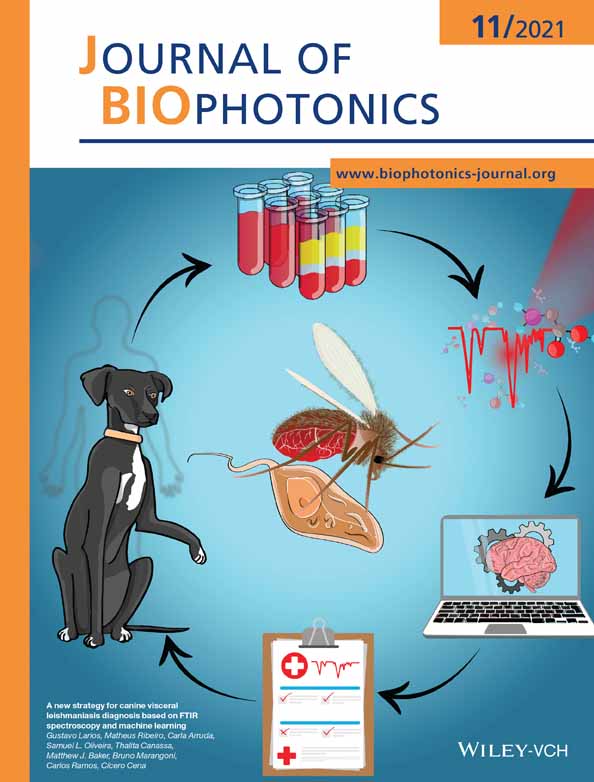 Removing dynamic distortions from laser speckle flowgraphy using eigen‐decomposition and spatial filtering