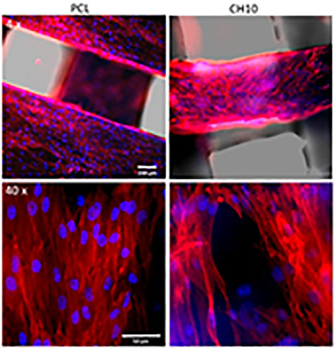 A comparison between β‐tricalcium phosphate verse chitosan poly‐caprolactone‐based 3D melt extruded composite scaffolds