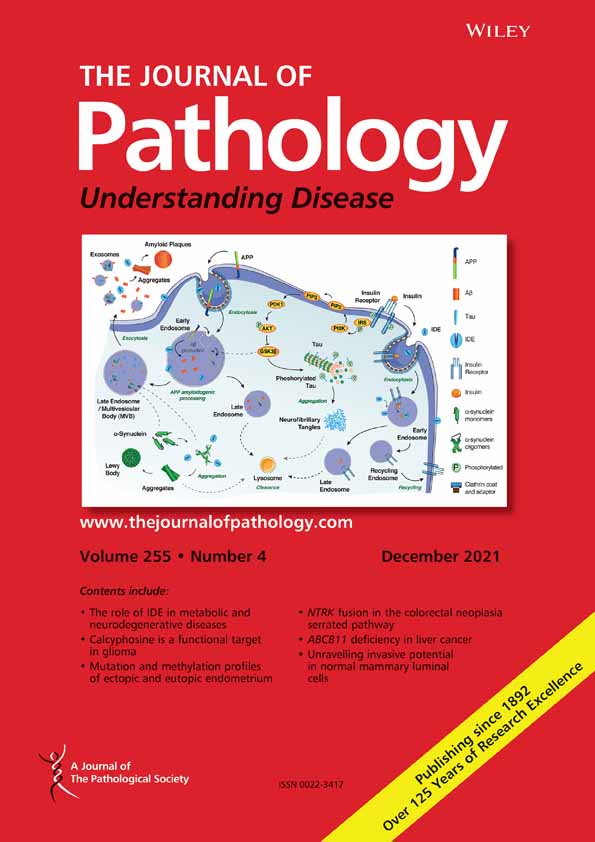 Monoallelic deleterious MUTYH germline variants as a driver for tumorigenesis