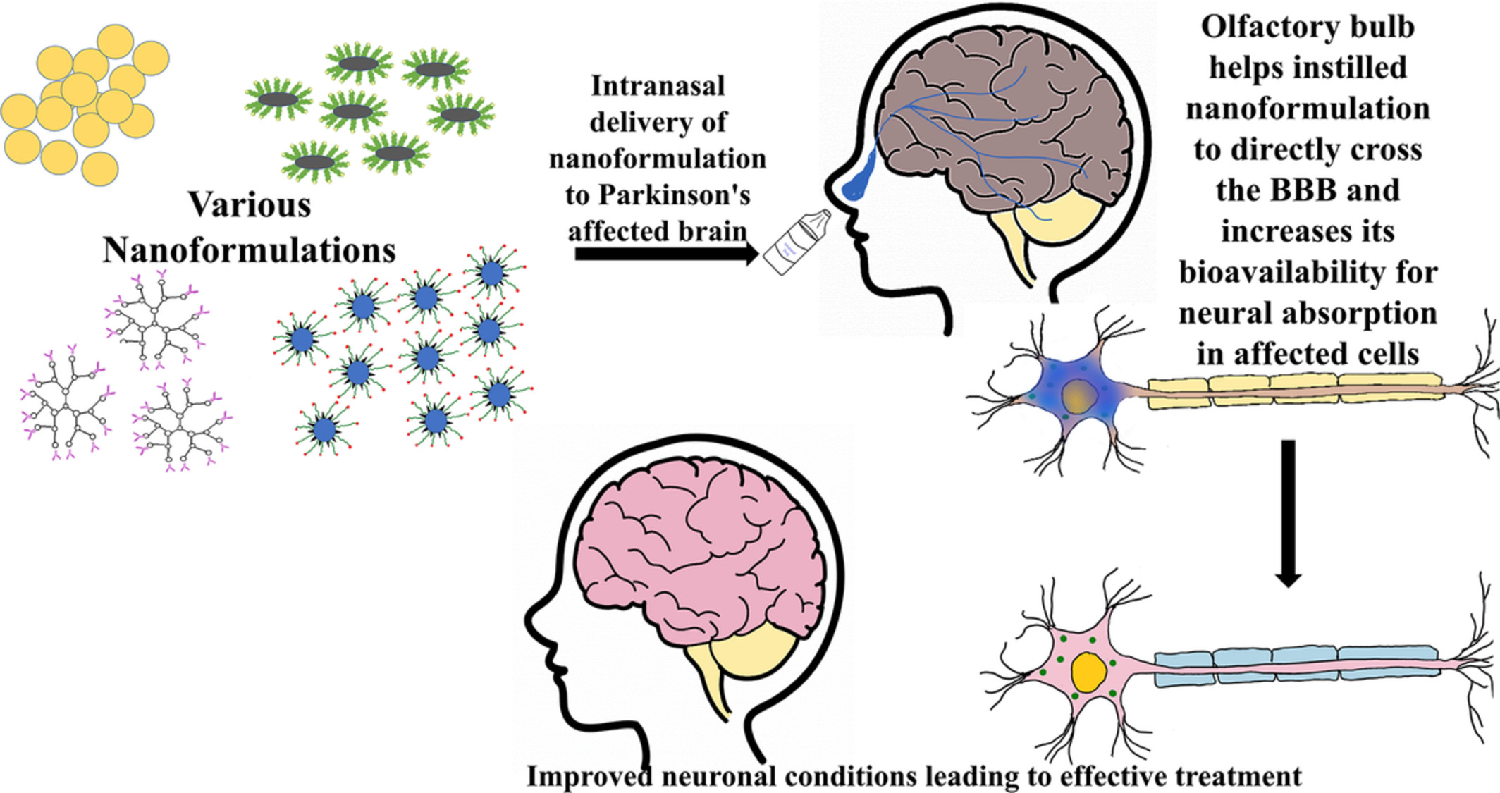 Designing nanoformulation for the nose‐to‐brain delivery in Parkinson's disease: Advancements and barrier