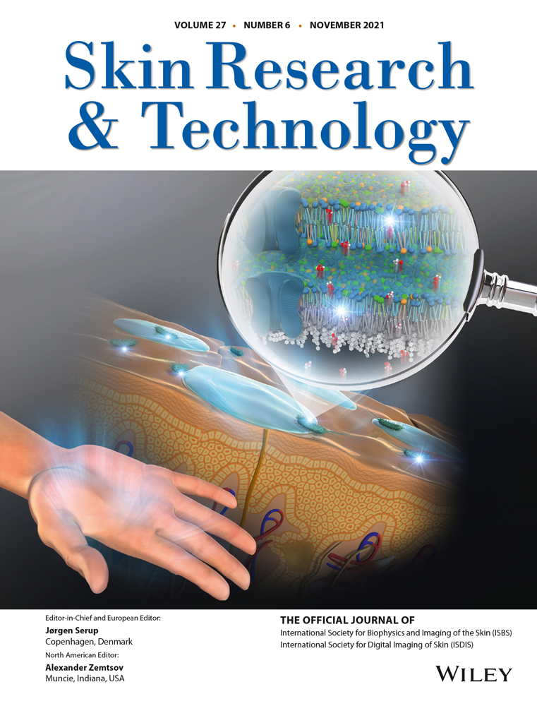 A three‐dimensional scar assessment tool for keloid scars: Volume, erythema and melanin quantified