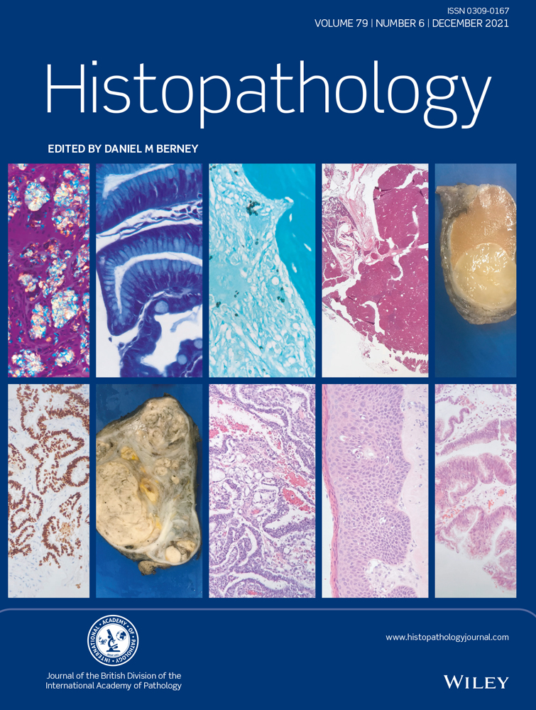 A mimic of lung adenocarcinoma: a case report of histological conversion of metastatic thyroid papillary carcinoma