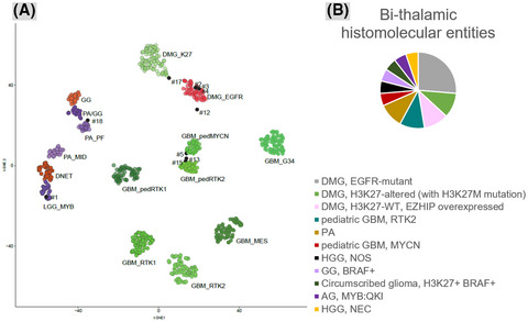 Deciphering the genetic and epigenetic landscape of pediatric bithalamic tumors