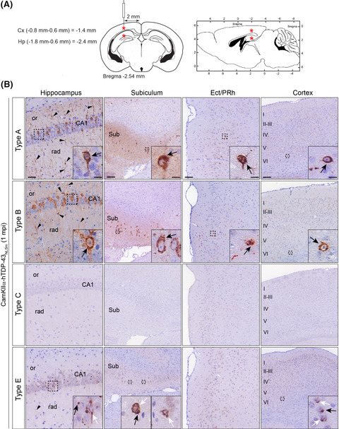 Distinct brain‐derived TDP‐43 strains from FTLD‐TDP subtypes induce diverse morphological TDP‐43 aggregates and spreading patterns in vitro and in vivo