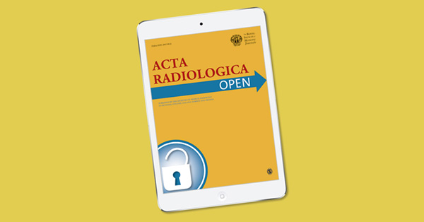 A case of primary aortic sarcoma with tumor infarction after stent graft placement