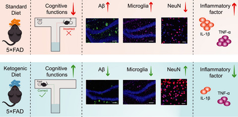 Ketogenic diet ameliorates cognitive impairment and neuroinflammation in a mouse model of Alzheimer’s disease