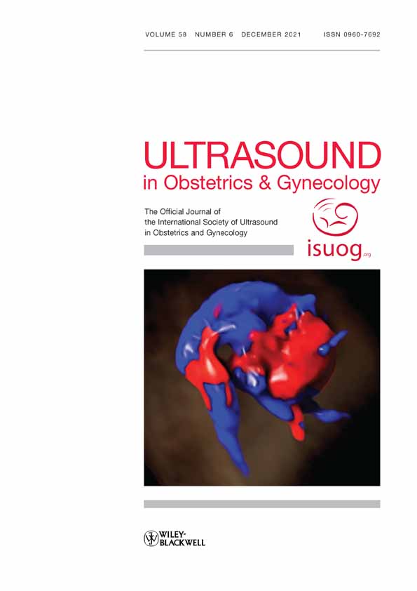 Reversed blood flow in the superior sagittal sinus in hydrops fetalis