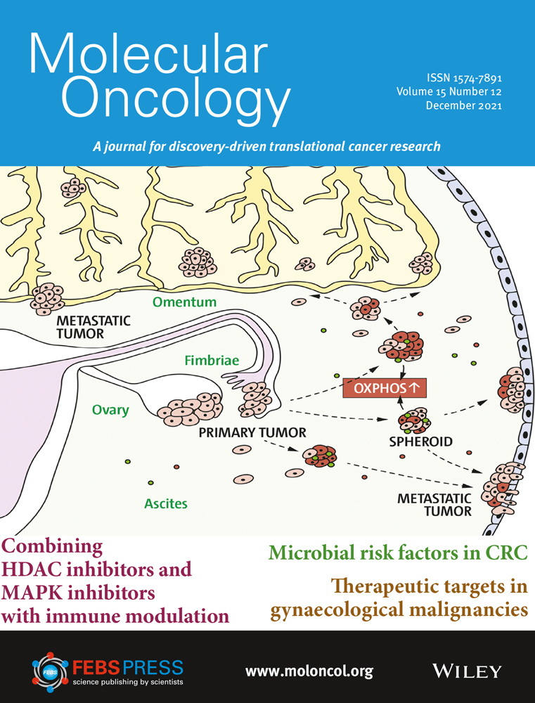 E‐cadherin is a robust prognostic biomarker in colorectal cancer and low expression is associated with sensitivity to inhibitors of topoisomerase, aurora and HSP90 in preclinical models